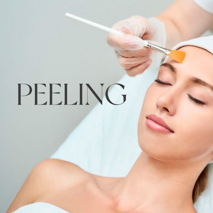 Um tratamento estético que utiliza ácidos para remover as camadas superficiais da pele, melhorando sua textura, aparência e suavizando as manchas.