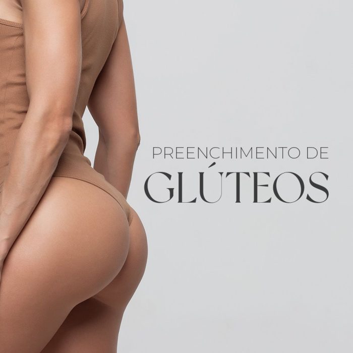 Uma técnica de aumento de volume nos glúteos utilizando preenchimentos injetáveis, com o objetivo de melhorar a sua forma e tamanho.